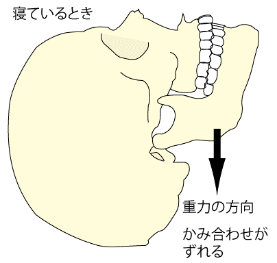 寝過ぎは歯の痛みの元です